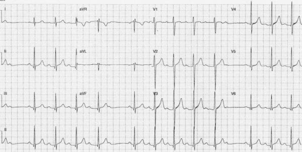 soal ekg no 10 Arkademi