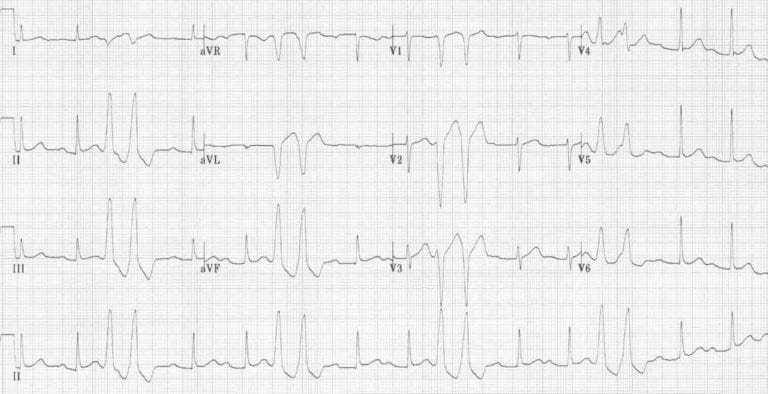 soal ekg no 4 Arkademi